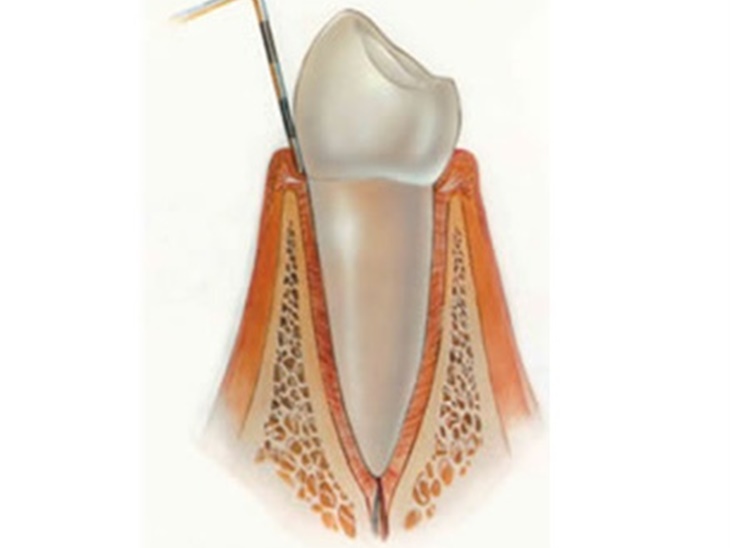 Parodontologia